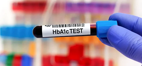 HbA1c