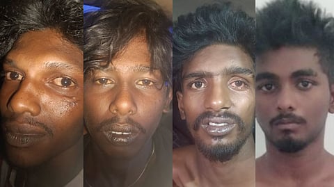 “எங்களுக்கு தெரியாத போலீசா” - மாறி மாறி அடித்துக் கொண்ட ரவுடிகள்.. தடுக்க சென்ற காவலருக்கு அரிவாள் வெட்டு!