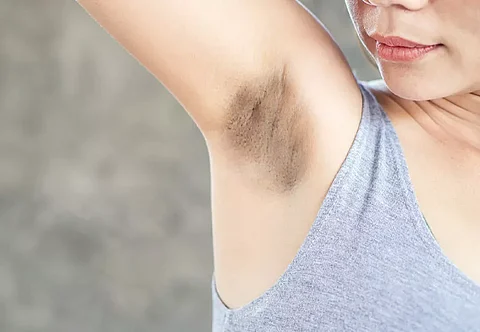 dark-armpit