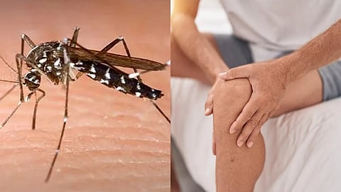 chikungunya-and-arthritis