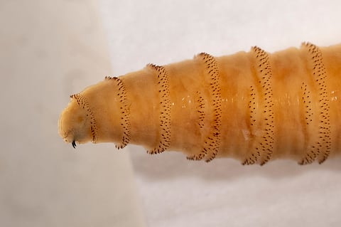 screwworm found in human body