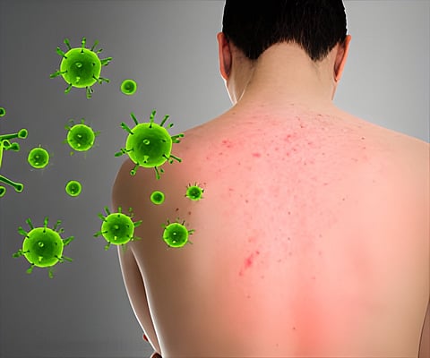 நாள்பட்ட அழற்சிக்கு முற்றுப்புள்ளி.. இந்த உணவுகளை கட்டாயம் எடுத்துக்கோங்க!