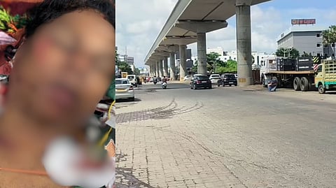 “நடுரோட்டில் வெட்டப்பட்ட திருநங்கை” - எட்டு மாதங்களாக நீடித்து வந்த பிரச்சனை.. குற்றவாளிக்கு உதவிய சக திருநங்கைகள்!