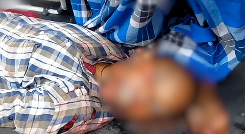 “திருமண ஆணுடன் பழகி வந்த இளம்பெண்” -  முகத்தில் சரமாரியாக வெட்டப்பட்ட கொடூரம்.. கள்ளக்காதலால் நடந்த கொலையா?