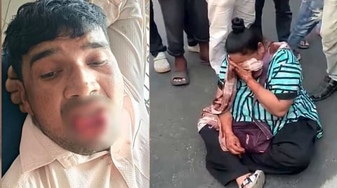 குளத்தாங்கரை அருகே.. பெண் தோழிக்கு "கட்டாய முத்தம்".. இரக்கம் பார்க்காமல் நாக்கைக் கடித்துத் துப்பி எறிந்த தோழி!