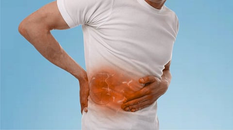 சிறுநீரகக் கற்களைத் துவம்சம் செய்யும் இயற்கை வழிகள்: அறுவை சிகிச்சை இல்லாமல் கற்களைக் கரைக்க முடியுமா?