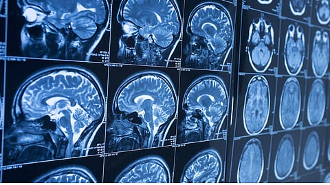 Neurosurgeons about brain