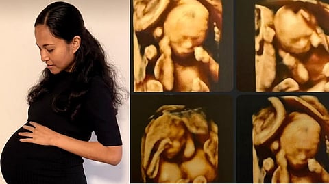 Australian couple quadruplets