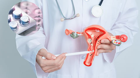 Cervical Cancer