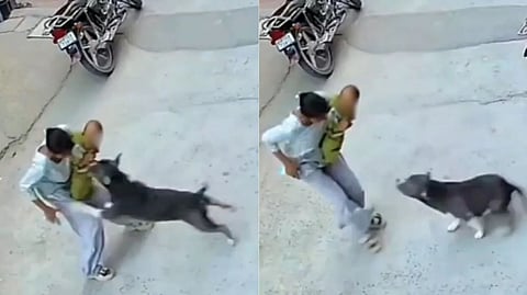 Pit bull attacks baby