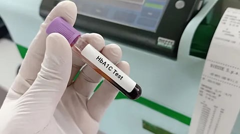 ஒரே ஒரு சர்க்கரை பரிசோதனை போதுமா? HbA1c சொல்லும் முக்கியமான தகவல்
