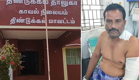 முன்விரோதம்...அதிமுக பிரமுகருக்கு கத்திக்குத்து