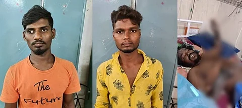 காப்பர் கம்பிகளை திருட முயற்சித்து மின்சார பெட்டிக்குள் கைவிட்ட நபர்.... கைகள் கருகிய நிலையில் மருத்துவமனையில் அனுமதி...!!