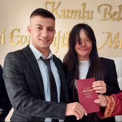 இதில் யாருக்கு தண்டனை..? ஆசிட் வீசிய காதலனை 13 வருடம் கழித்து கைகோர்த்த காதலி...