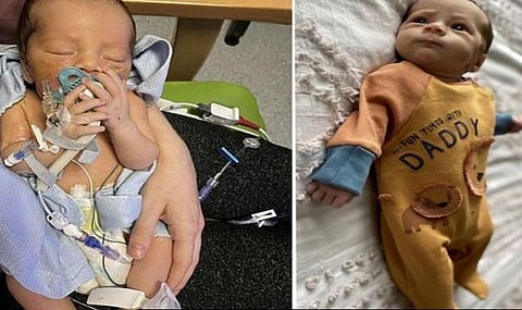 குழந்தைக்கு அபூர்வ உடல் குறைப்பாடு!வயிற்றுக்கு வெளியே வளரும் உடல் உறுப்புகள்!