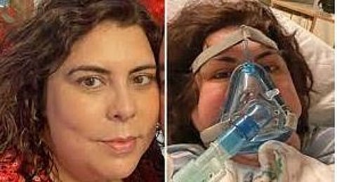 கோமாவில் இருந்த பெண்ணுக்கு வயாகரா கொடுத்தே உயிரை காப்பாற்றிய மருத்துவர்!!!