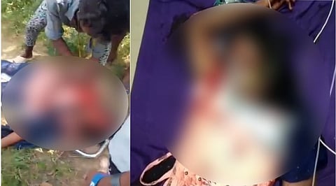 இளம் பெண்ணை சுத்தியலால் தாக்கிவிட்டு தப்பி ஓடிய வாலிபர்!