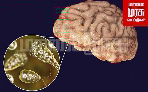 “மூளையை உண்ணும் அமீபா..” பதிவான முதல் உயிரிழப்பு..! அச்சத்தில் மக்கள்..!