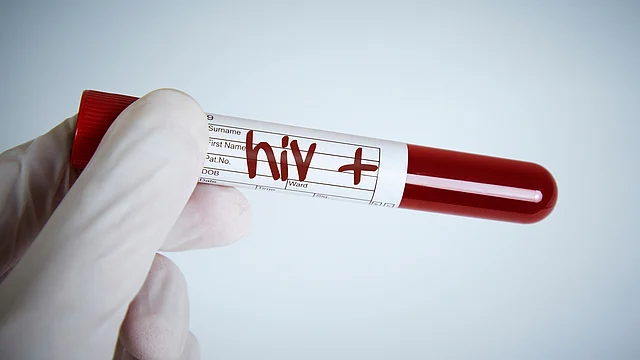 The government and private banks follow different criteria in blood banks for (Photo: iStockphoto)