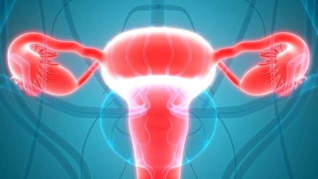 Most women are diagnosed in the advanced stages (3rd or 4th) of ovarian cancer.