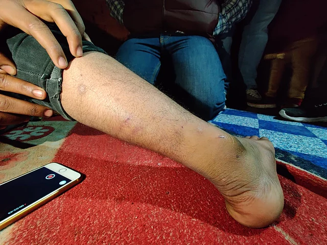 Showing me his bruises, here is Atif.