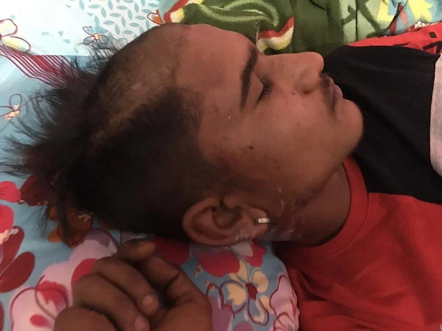 Rahul's head was forcefully shaved by one of the accused.