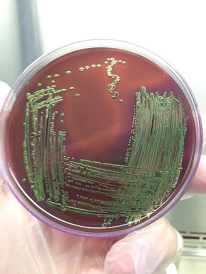 Antibiotic use in animals can over time promote the development of hard-to-treat antibiotic-resistant superbugs that make people sick.