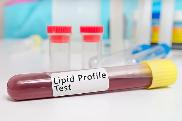 A simple blood check helps in detecting if the cholesterol level in the blood is under control.