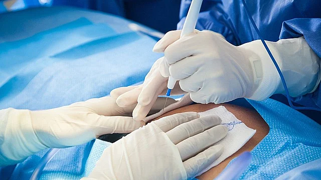 Indian Express investigated some Delhi clinics to highlight the conditions in which implant surgeries are performed. 