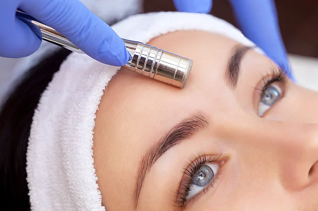 Dermabrasion, microdermabrasion and laser therapy are some of the treatments recommended by doctors for hyperpigmentation