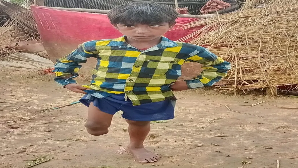jamui handicapped student amit waiting for help as sima got helped after video gone viral skt | Jamui: दिव्यांग छात्रा सीमा को मिली मदद तो अमित को भी अब आस, सरकारी सहायता