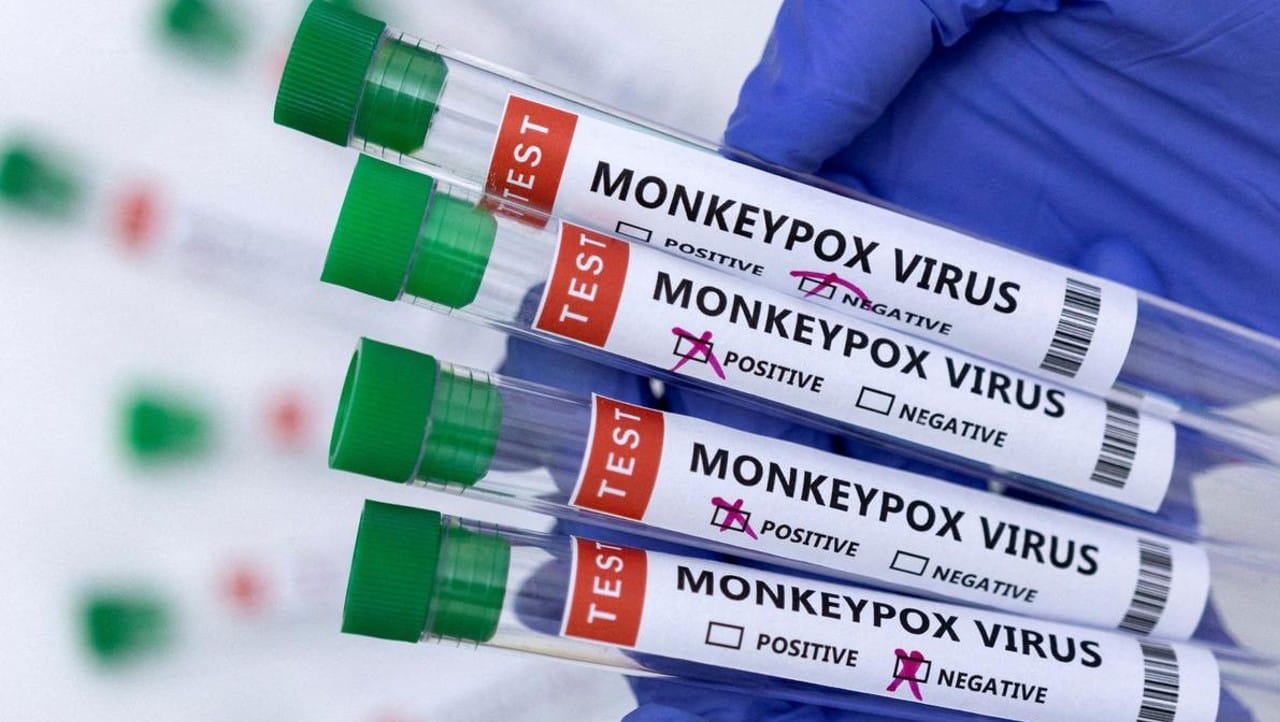 Monkeypox Cases: मंकीपॉक्स के मामले सामने आने के बाद केरल सरकार ने जारी की SOP, जानिए इसके लक्षण
