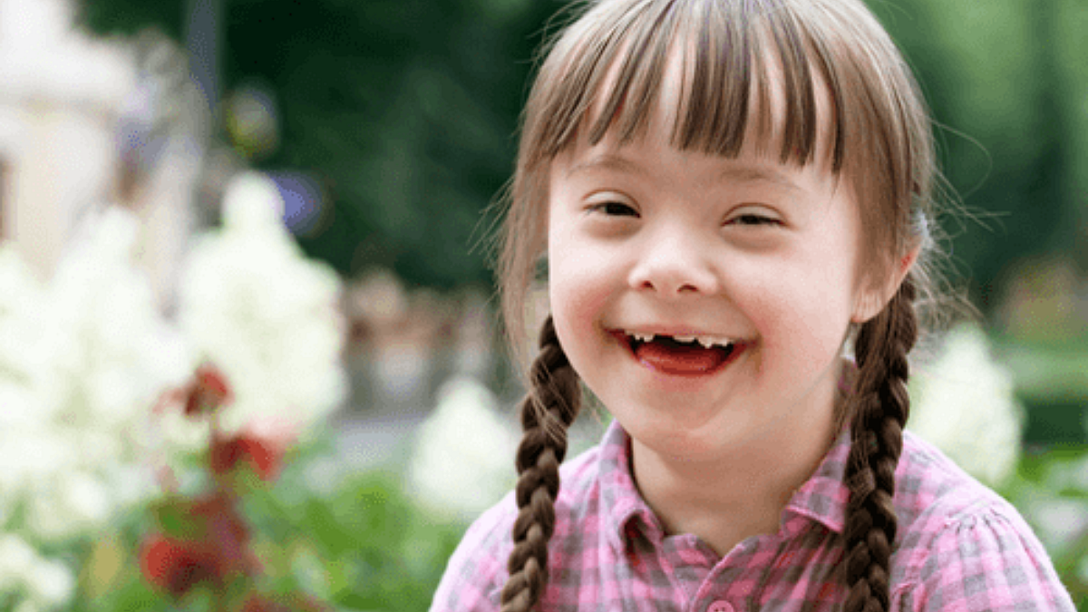 Down Syndrome