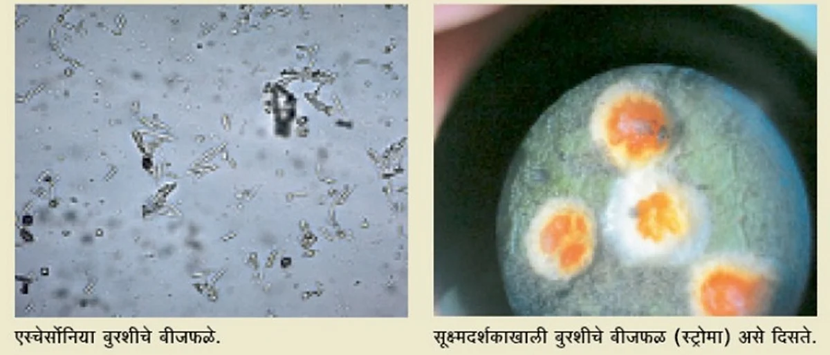 microscopic view of Escherzonia fungi stroma