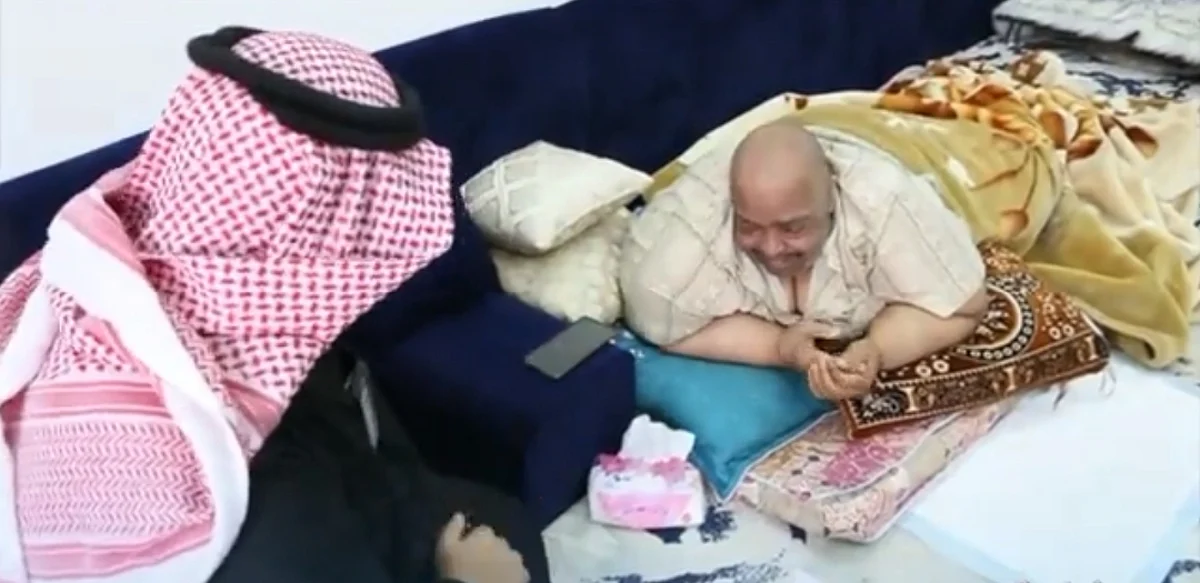 بالفيديو.. تحرك سريع من "صحة الجوف" لإنهاء معاناة مريض سمنة لازم الفراش 12 عامًا