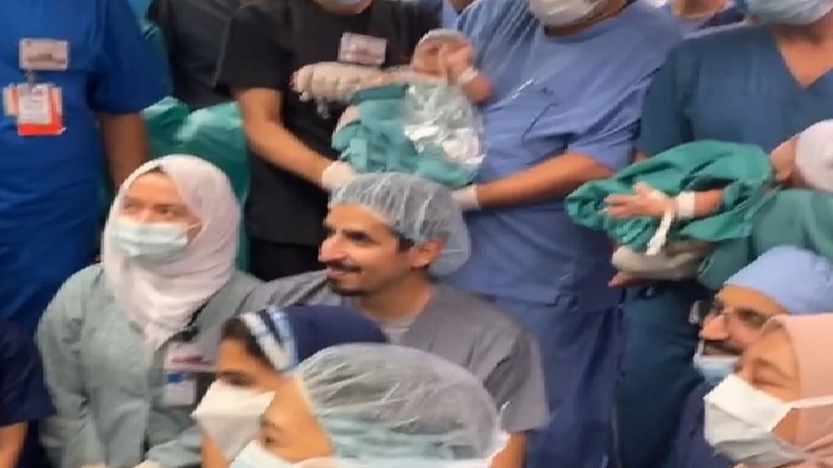 الاحتفال بفصل التؤأم اليمني مودة ورحمة