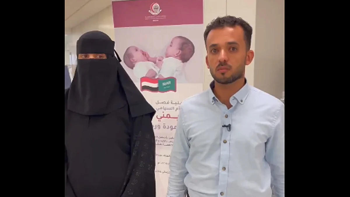 والدة التؤام السيامي مودة ورحمة