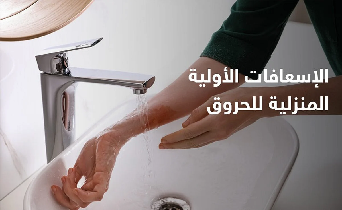 طرق الإسعافات الأولية المنزلية للحروق.. عليك معرفتها
