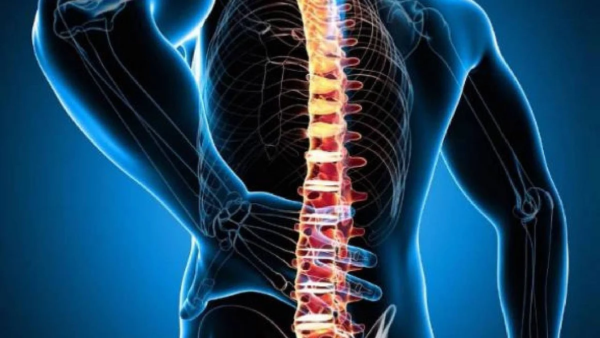 في اليوم العالمي للوقاية من هشاشة العظام.. تعرف الأعراض وأسباب الإصابة به