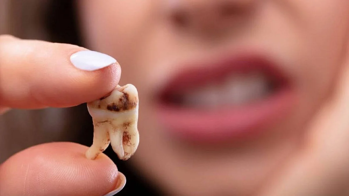 الصحة: 7 خطوات للوقاية من تسوس الأسنان