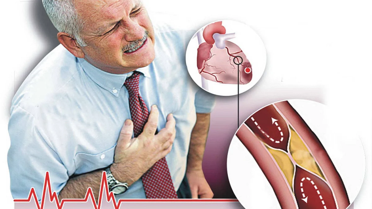 النمر يحذر مرضى القلب من 3 تصرفات خاطئة عند حدوث الجلطة