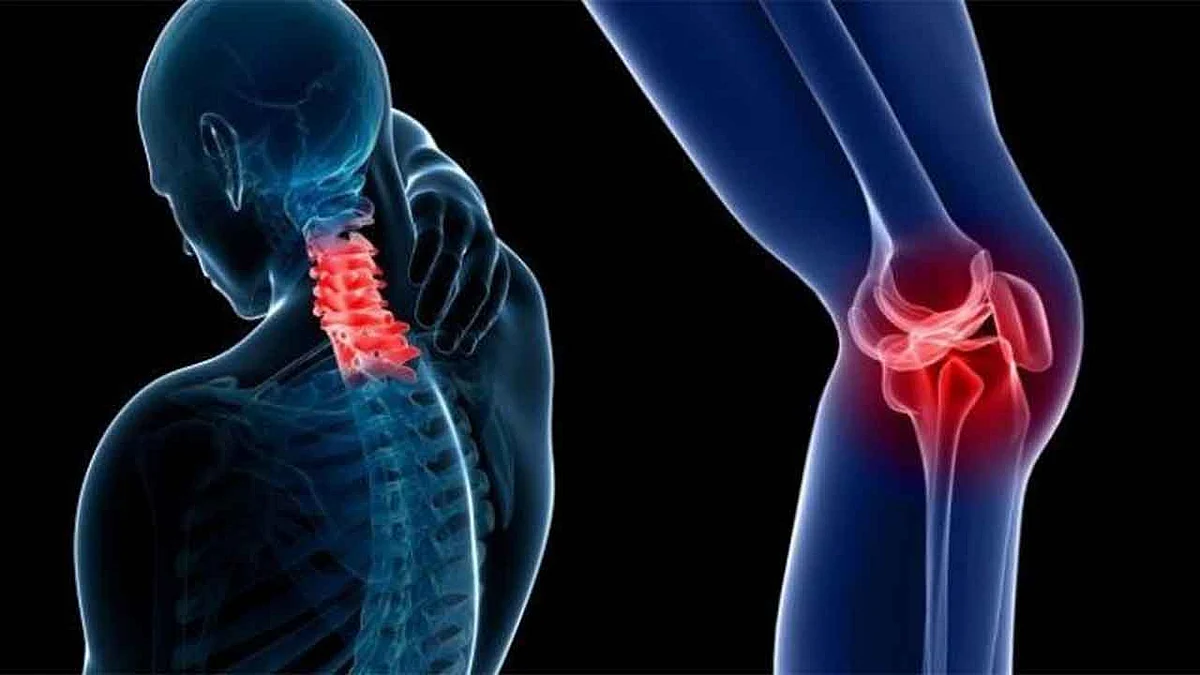 4 أسباب تؤدي إلى هشاشة العظام.. وخبراء يطرحون طرق العلاج