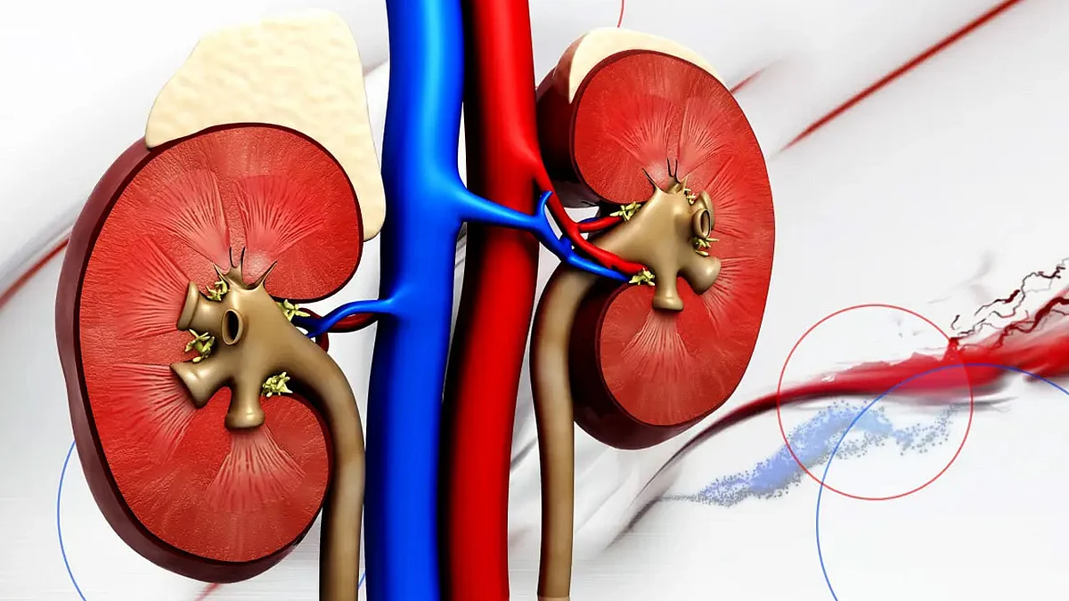فحص بسيط ومبكر يجنب مصابي مرض الكلى مضاعفات خطيرة