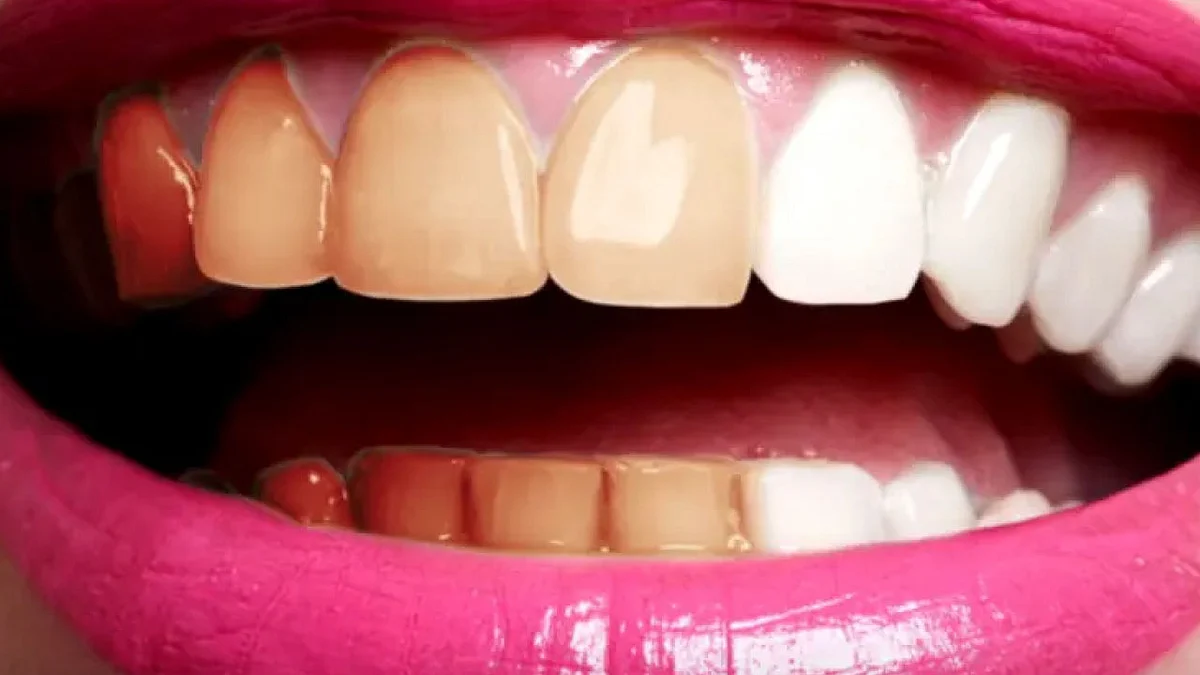 3 أطعمة تؤثر على لون الأسنان الطبيعي منها الكاتشب