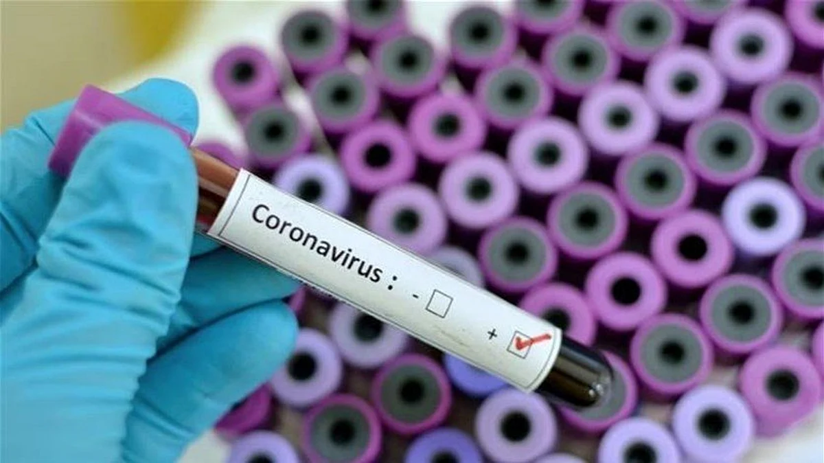 Saudi Arabia Announces its first Coronavirus Death