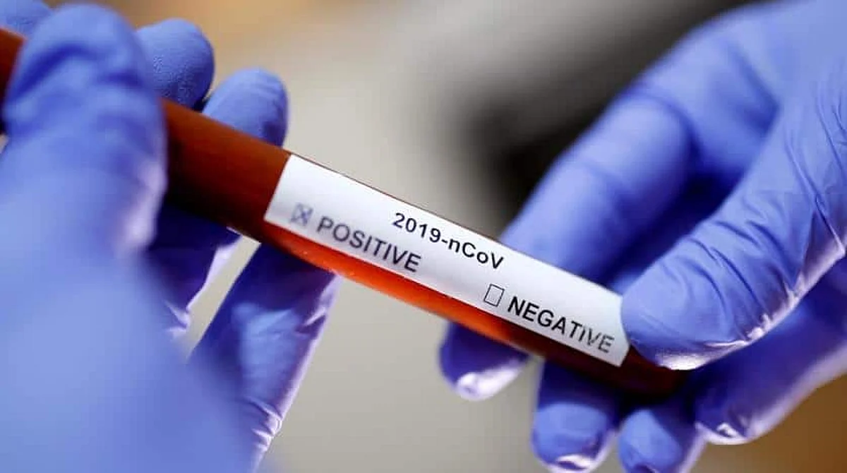 A test tube with coronavirus name label is seen in this illustration taken on January 29, 2020. (Reuters)