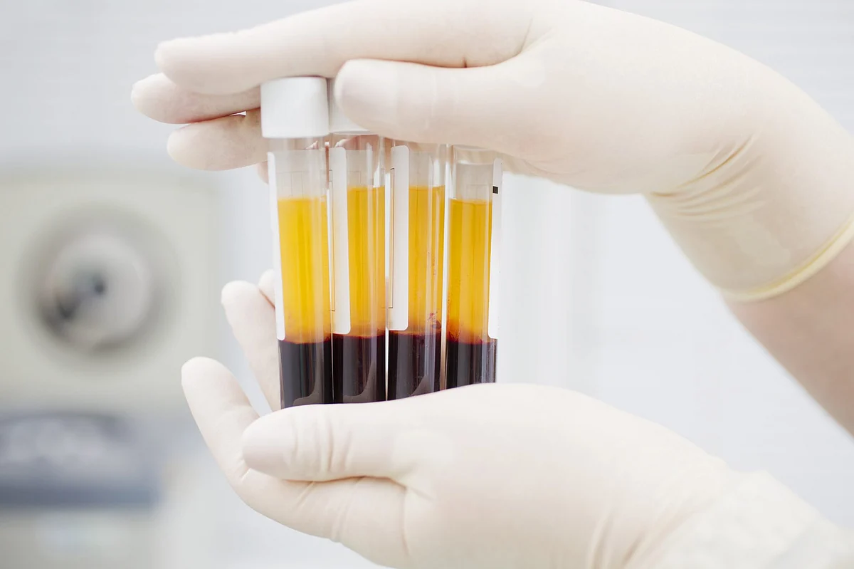 100 COVID-19 patients benefit from blood plasma treatment