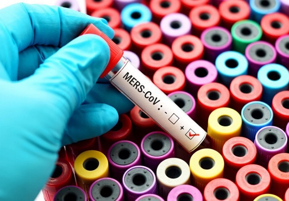 King Abdullah International Medical Research Center Conducts Only Study in the World for Treating MERS