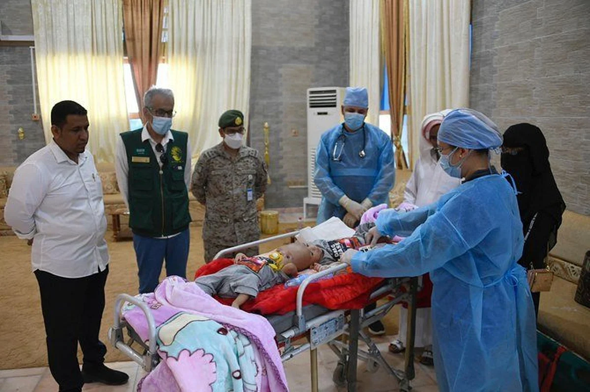 Yemeni conjoined twins arrive safely in Saudi Arabia