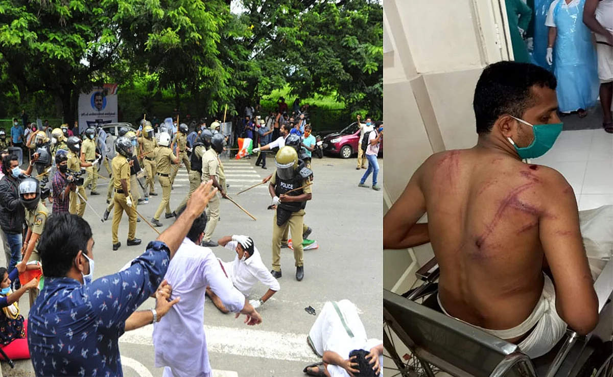 ജലീൽ വിരുദ്ധ സമരം: പോലീസ് അക്രമത്തിൽ നടപടിയുമായി ദേശീയ മനുഷ്യാവകാശ കമ്മീഷൻ